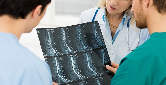 Lülisamba röntgenülesvõte osteokondroosi diagnoosimiseks